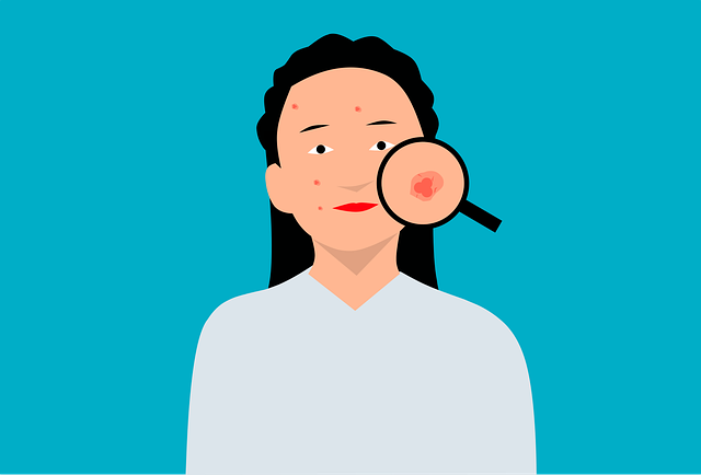 illustration of a young woman with acne and red spots on her face with a magnifying glass zoomed into a pimple